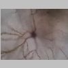 Neuronas Golgi 32.jpg